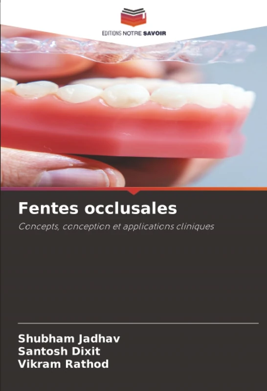 Fentes occlusales: Concepts, conception et applications cliniques