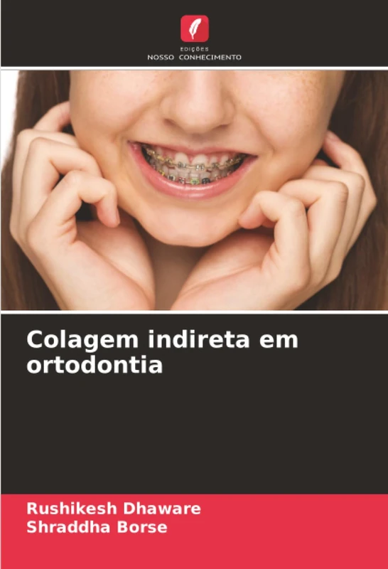 Colagem indireta em ortodontia