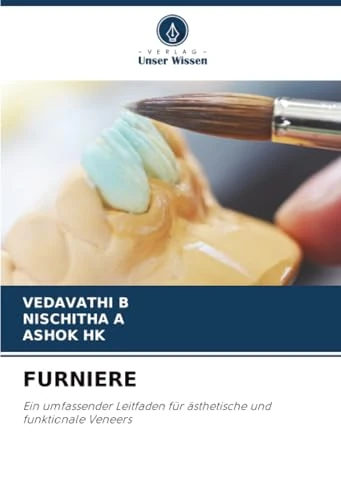 FURNIERE: Ein umfassender Leitfaden für ästhetische und funktionale Veneers