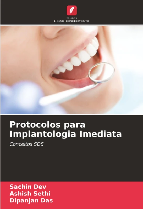 Protocolos para Implantologia Imediata: Conceitos SDS