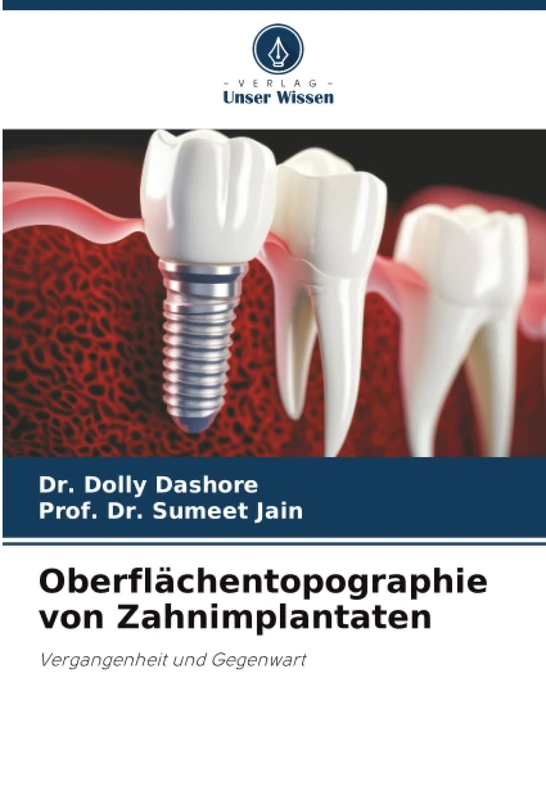 Oberflächentopographie von Zahnimplantaten: Vergangenheit und Gegenwart