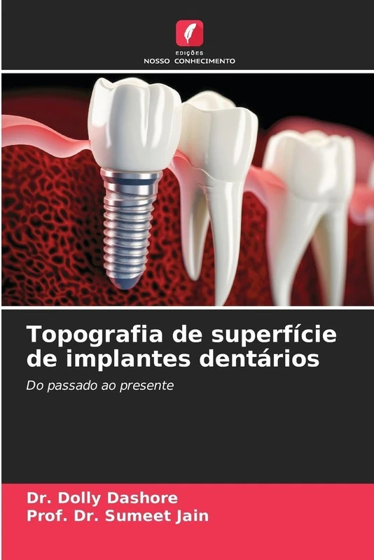 Topografia de superfície de implantes dentários: Do passado ao presente