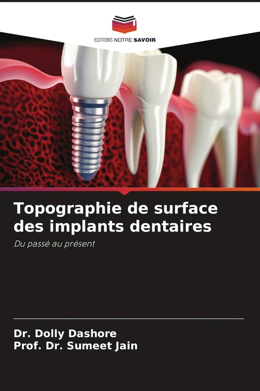 Topographie de surface des implants dentaires: Du passé au présent