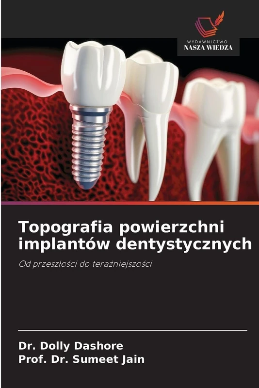 Topografia powierzchni implantów dentystycznych: Od przeszłości do teraźniejszości: Od przesz¿o¿ci do tera¿niejszo¿ci