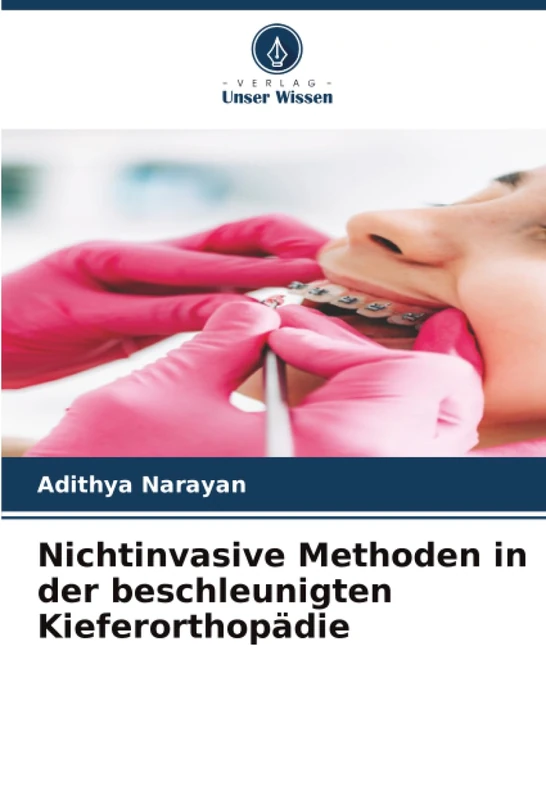 Nichtinvasive Methoden in der beschleunigten Kieferorthopädie - Image 1