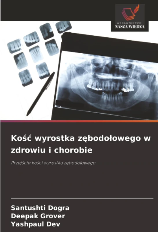 Kość wyrostka zębodołowego w zdrowiu i chorobie: Przejście kości wyrostka zębodołowego: Przej¿cie ko¿ci wyrostka z¿bodo¿owego
