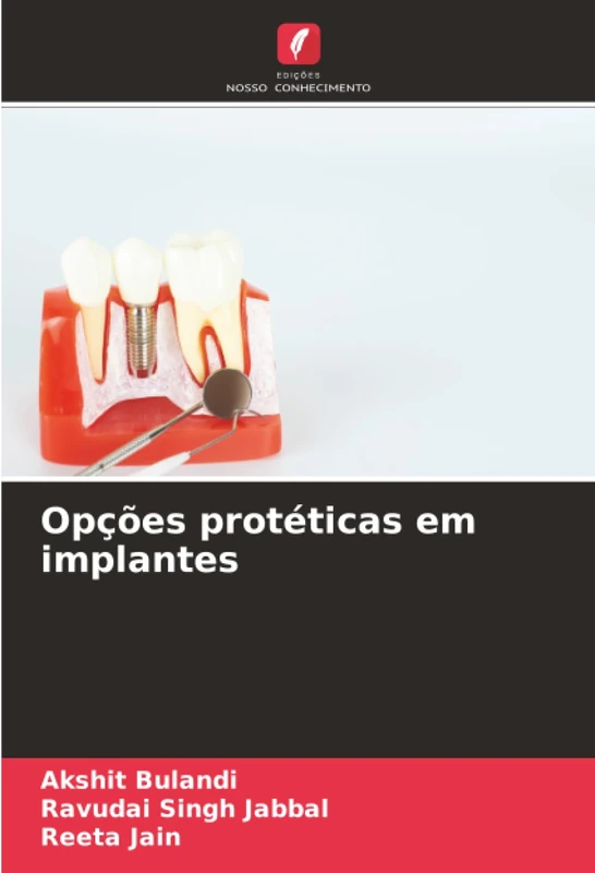 Opções protéticas em implantes - Image 1