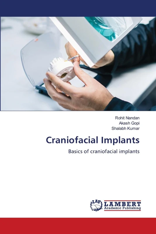 Craniofacial Implants: Basics of craniofacial implants