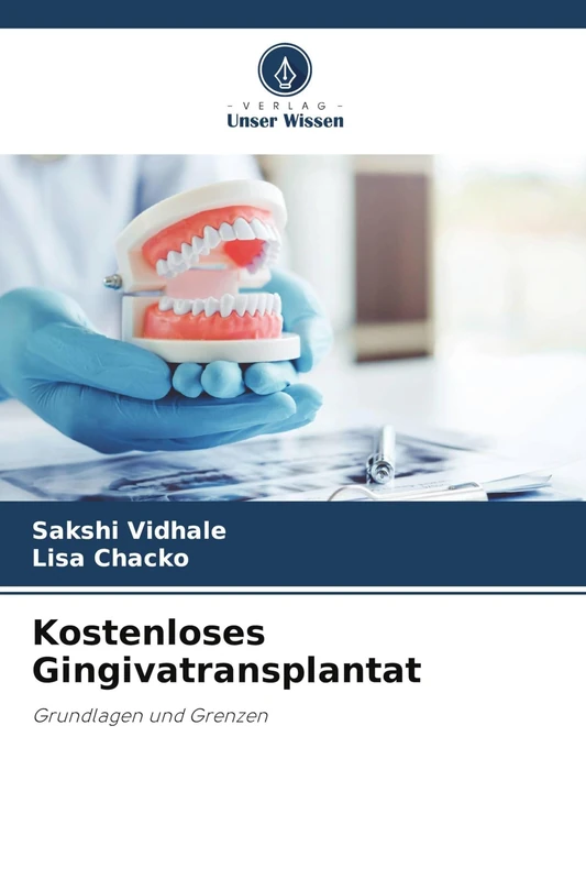 Kostenloses Gingivatransplantat: Grundlagen und Grenzen - Image 1