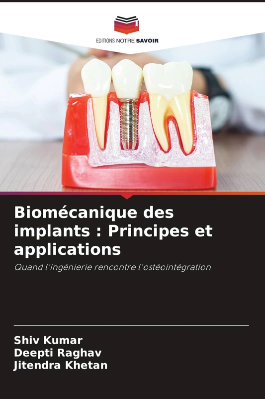Biomécanique des implants: Principes et applications