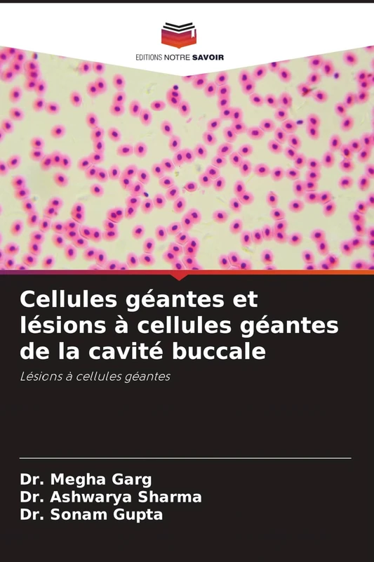 Cellules géantes et lésions à cellules géantes de la cavité buccale