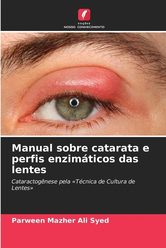 Manual sobre catarata e perfis enzimáticos das lentes: Cataractogênese pela 'Técnica de Cultura de Lentes' - Image 1