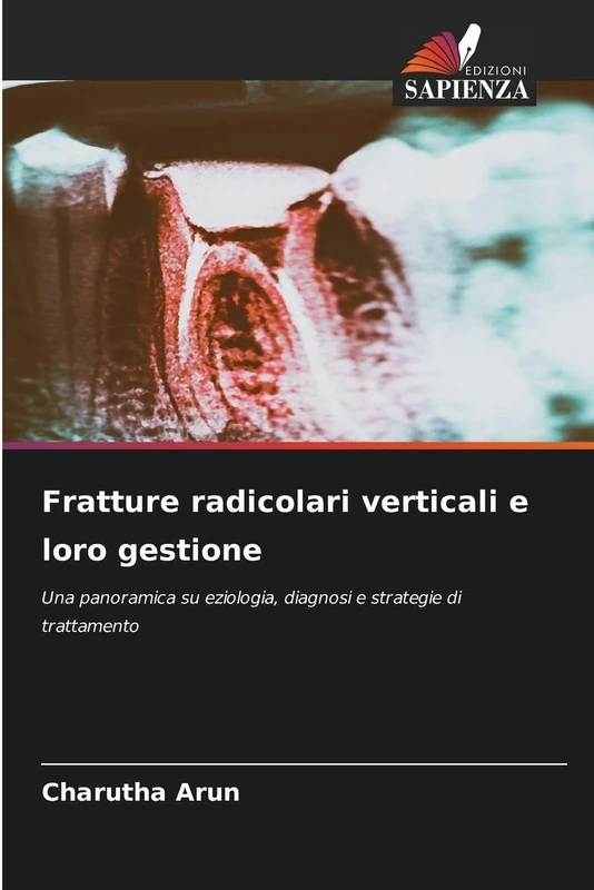 Fratture radicolari verticali e loro gestione: Una panoramica su eziologia, diagnosi e strategie di trattamento