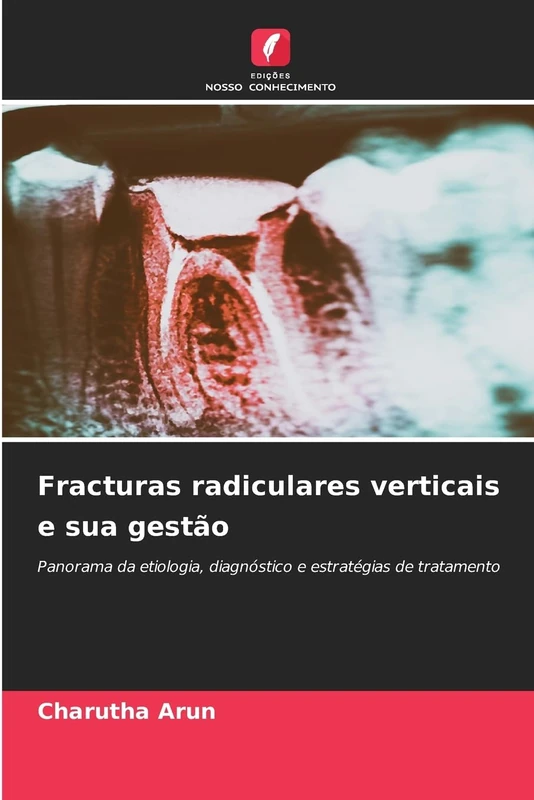 Fracturas radiculares verticais e sua gestão: Panorama da etiologia, diagnóstico e estratégias de tratamento