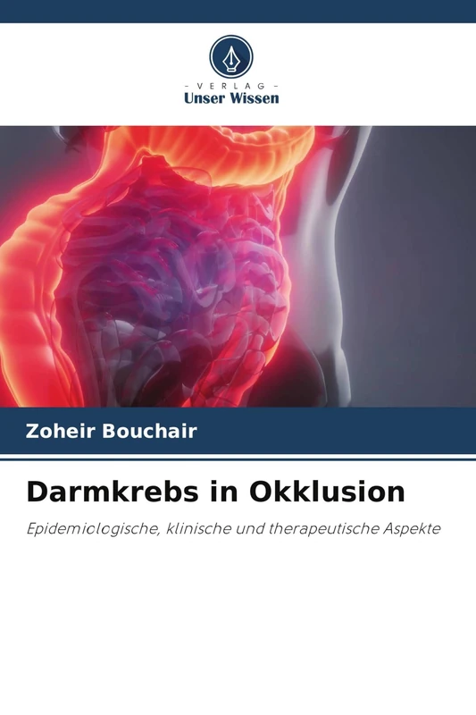 Darmkrebs in Okklusion: Epidemiologische, klinische und therapeutische Aspekte - Image 1