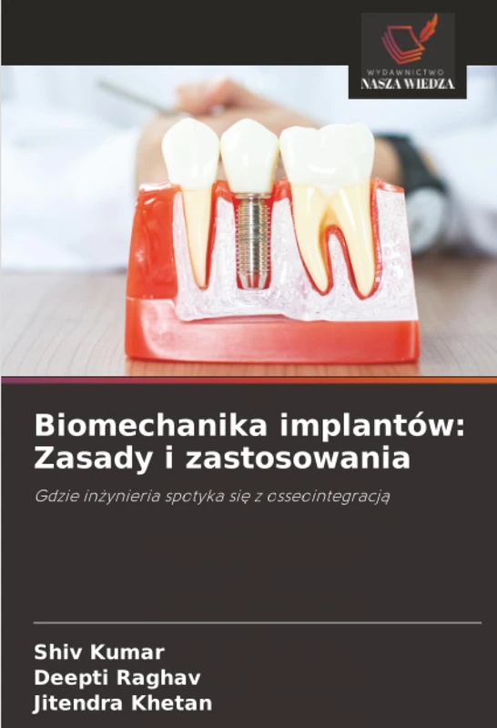 Biomechanika implantów: Zasady i zastosowania: Gdzie inżynieria spotyka się z osseointegracją