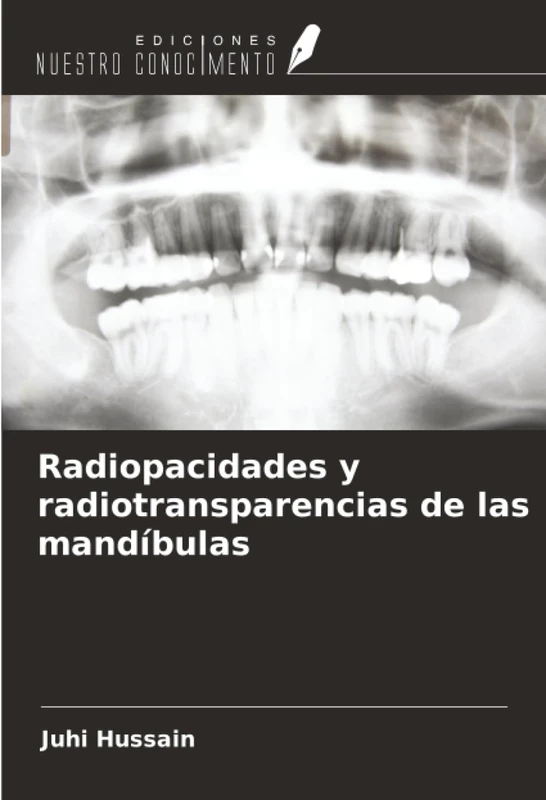 Radiopacidades y radiotransparencias de las mandíbulas