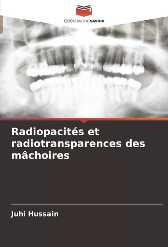 Radiopacités et radiotransparences des mâchoires