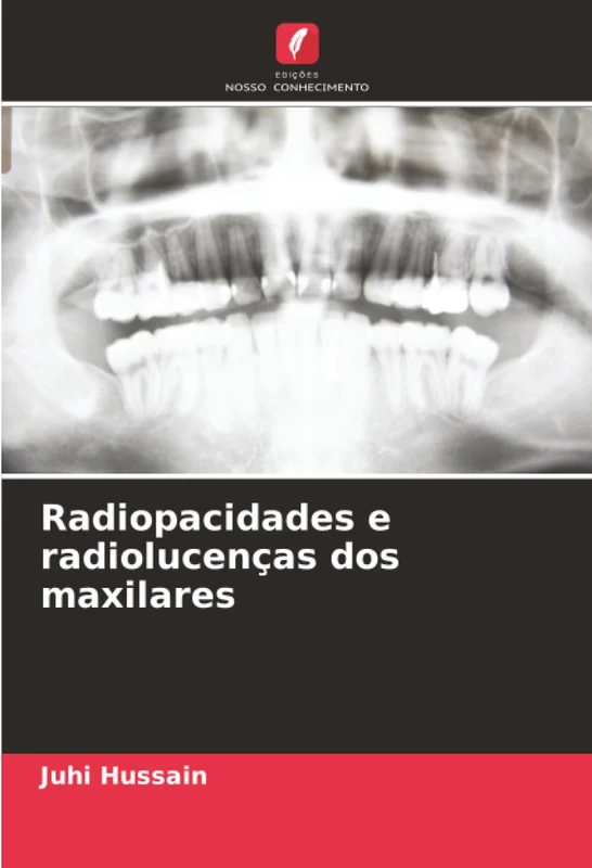 Radiopacidades e radiolucenças dos maxilares