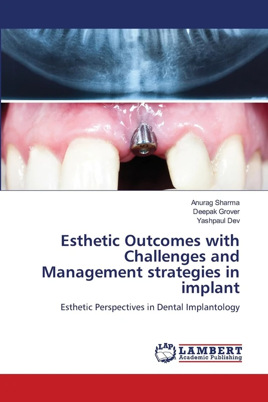 Esthetic Outcomes with Challenges and Management strategies in implant: Esthetic Perspectives in Dental Implantology
