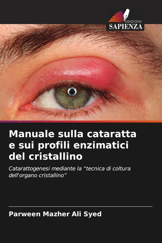 Manuale sulla cataratta e sui profili enzimatici del cristallino: Catarattogenesi mediante la "tecnica di coltura dell'organo cristallino" - Image 1