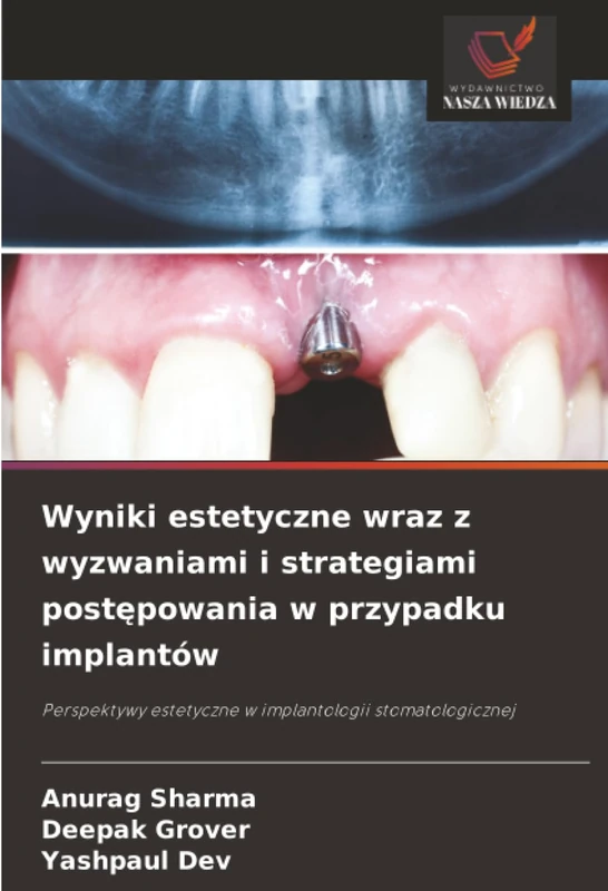 Wyniki estetyczne wraz z wyzwaniami i strategiami postępowania w przypadku implantów: Perspektywy estetyczne w implantologii stomatologicznej