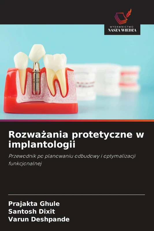 Rozważania protetyczne w implantologii: Przewodnik po planowaniu odbudowy i optymalizacji funkcjonalnej