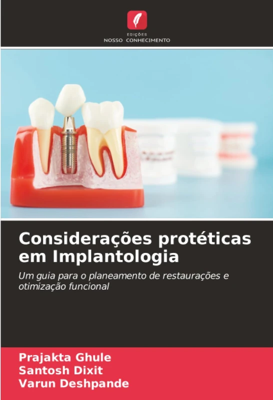 Considerações protéticas em Implantologia: Um guia para o planeamento de restaurações e otimização funcional