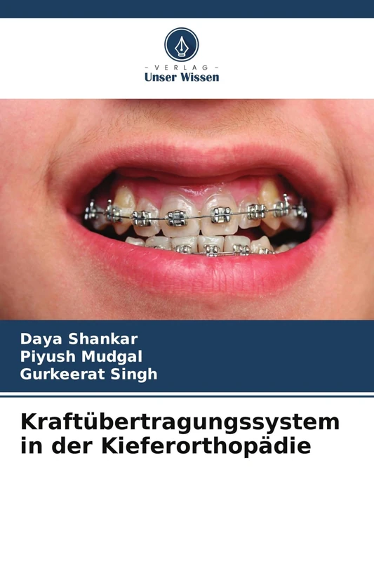 Kraftübertragungssystem in der Kieferorthopädie