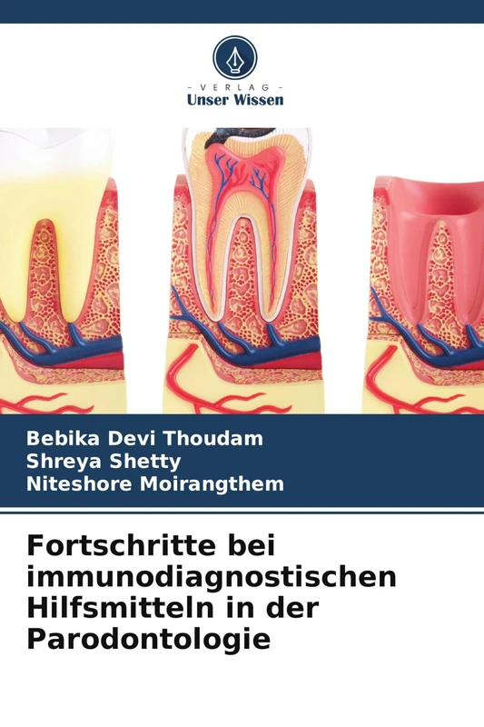 Fortschritte bei immunodiagnostischen Hilfsmitteln in der Parodontologie