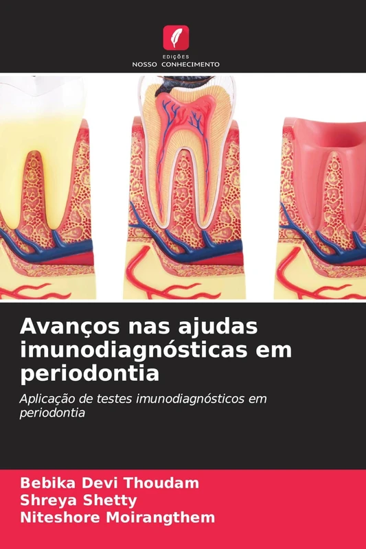 Avanços nas ajudas imunodiagnósticas em periodontia: Aplicação de testes imunodiagnósticos em periodontia