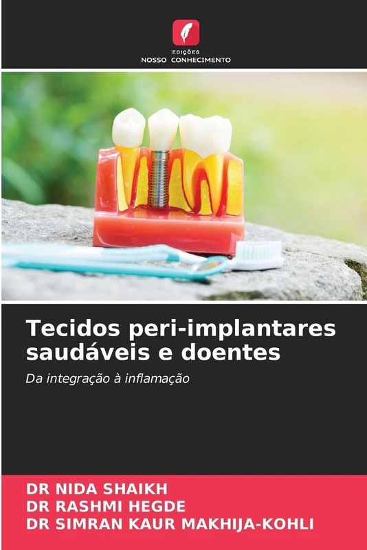 Tecidos peri-implantares saudáveis e doentes: Da integração à inflamação - Image 1