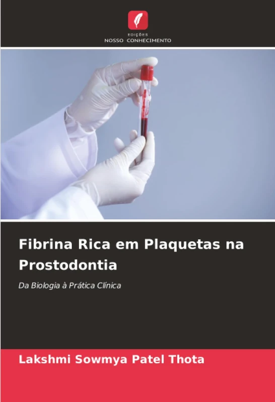Fibrina Rica em Plaquetas na Prostodontia: Da Biologia à Prática Clínica