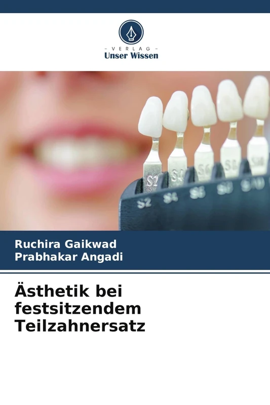 Ästhetik bei festsitzendem Teilzahnersatz - Image 1