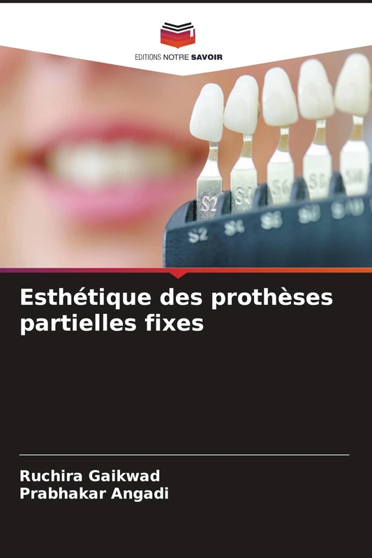 Esthétique des prothèses partielles fixes