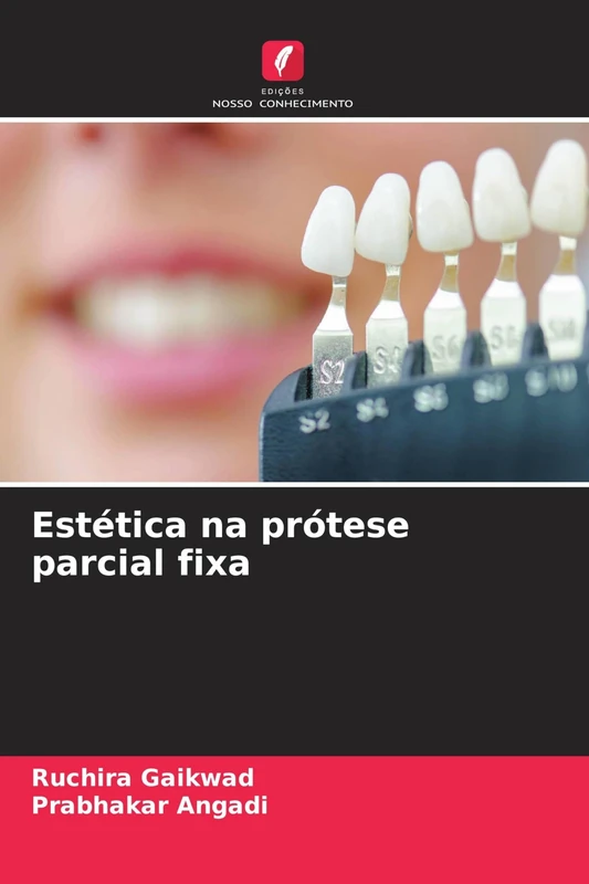 Estética na prótese parcial fixa - Image 1