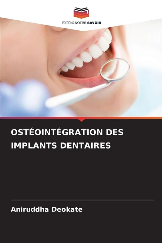 OSTÉOINTÉGRATION DES IMPLANTS DENTAIRES - Image 1