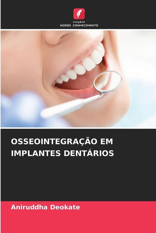 Osseointegração Em Implantes Dentários