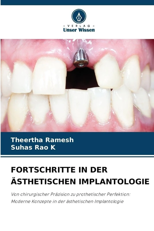 Fortschritte in Der Ästhetischen Implantologie: Von chirurgischer Präzision zu prothetischer Perfektion: Moderne Konzepte in der ästhetischen Implantologie