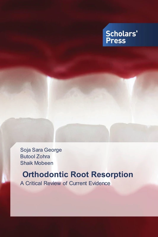 Orthodontic Root Resorption: A Critical Review of Current Evidence
