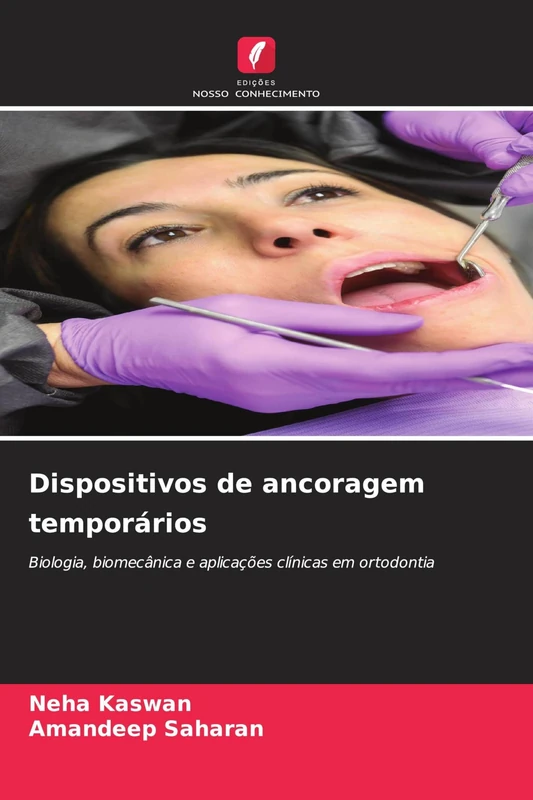 Dispositivos de ancoragem temporários: Biologia, biomecânica e aplicações clínicas em ortodontia