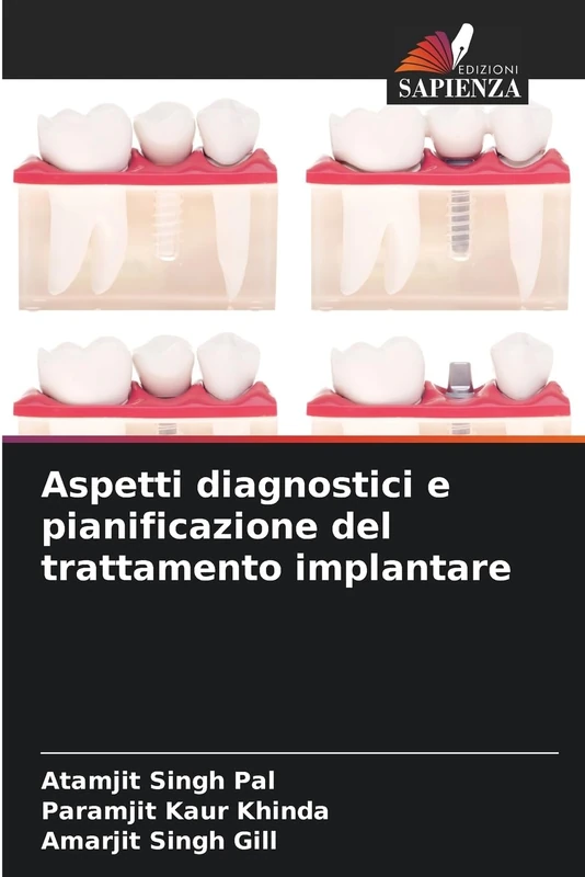 Aspetti diagnostici e pianificazione del trattamento implantare