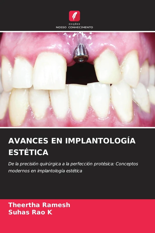 Avances En Implantología Estética: De la precisión quirúrgica a la perfección protésica: Conceptos modernos en implantología estética