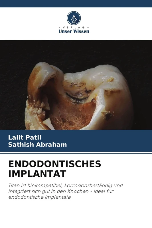 ENDODONTISCHES IMPLANTAT: Titan ist biokompatibel, korrosionsbeständig und integriert sich gut in den Knochen - ideal für endodontische Implantate - Image 1
