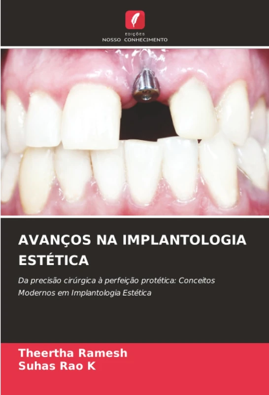 AVANÇOS NA IMPLANTOLOGIA ESTÉTICA: Da precisão cirúrgica à perfeição protética: Conceitos Modernos em Implantologia Estética