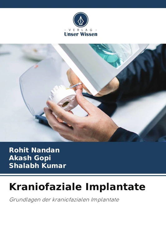 Kraniofaziale Implantate: Grundlagen der kraniofazialen Implantate