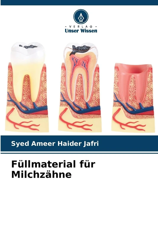 Füllmaterial für Milchzähne