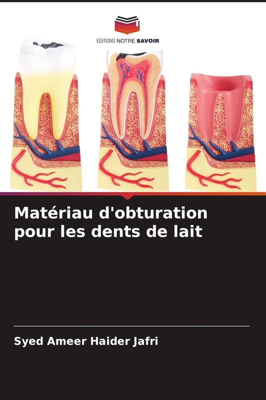Matériau d'obturation pour les dents de lait