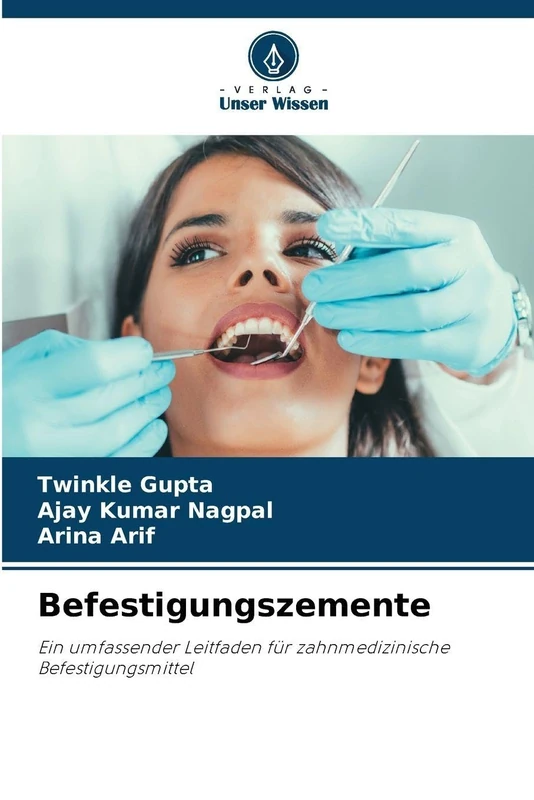 Befestigungszemente: Ein umfassender Leitfaden für zahnmedizinische Befestigungsmittel