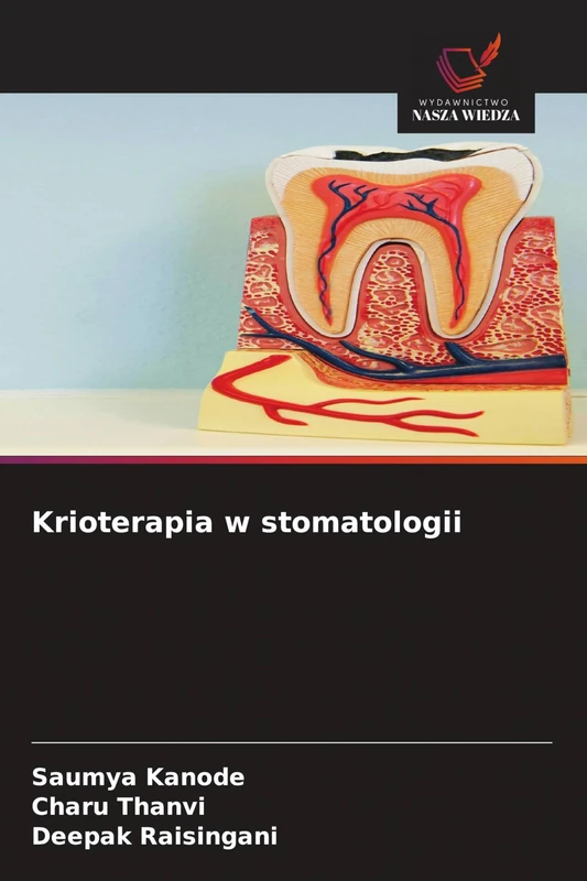 Krioterapia w stomatologii